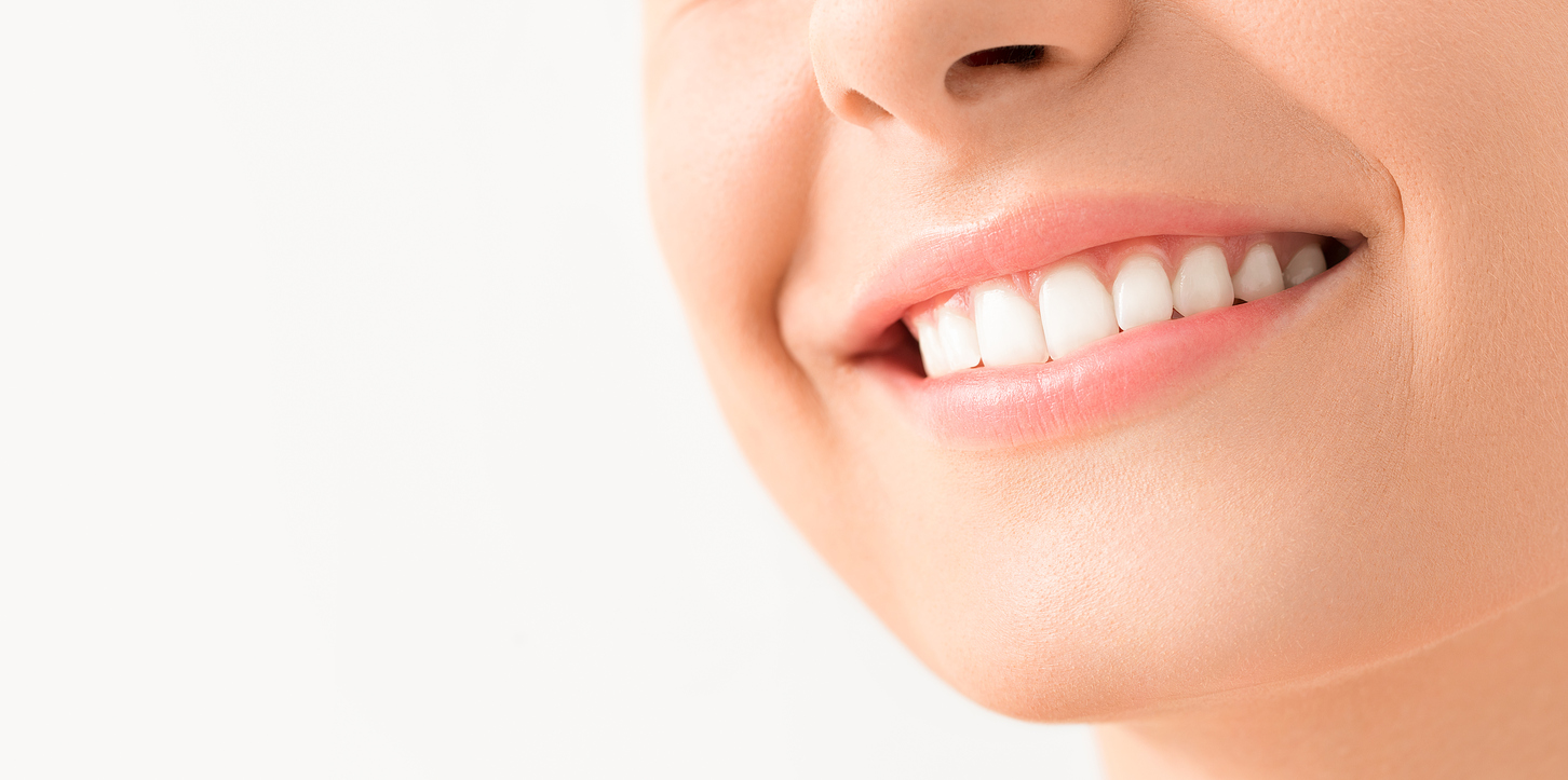 Teeth Whitening San Gabriel