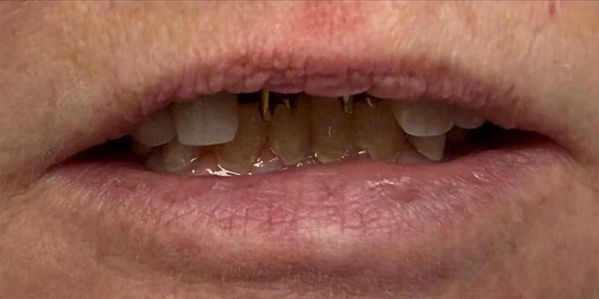 Smile Gallery