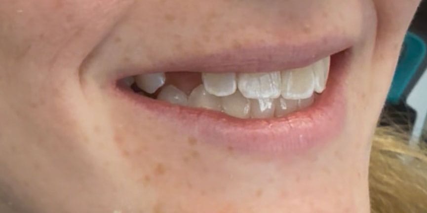 Smile Gallery