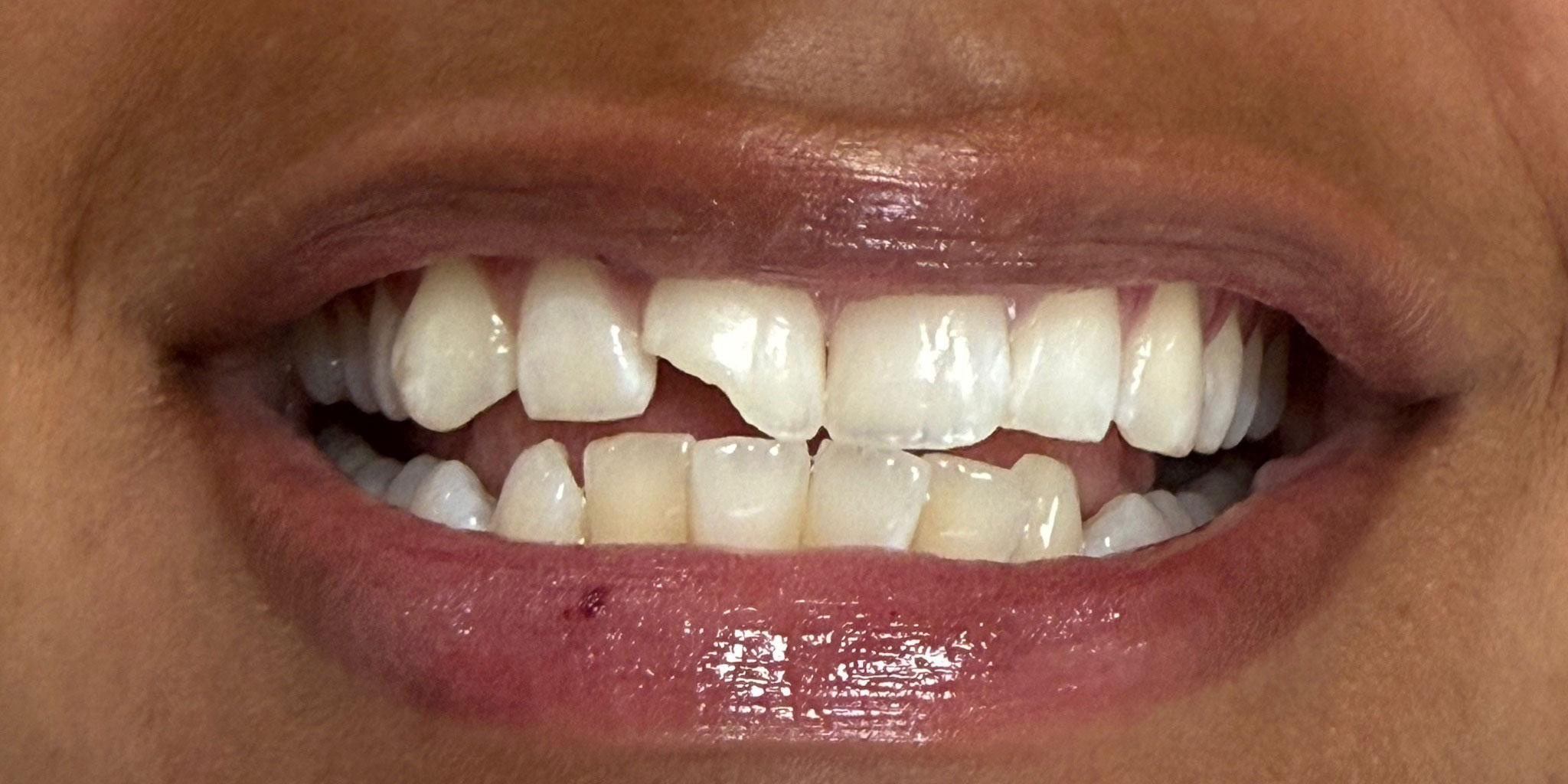 Smile Gallery