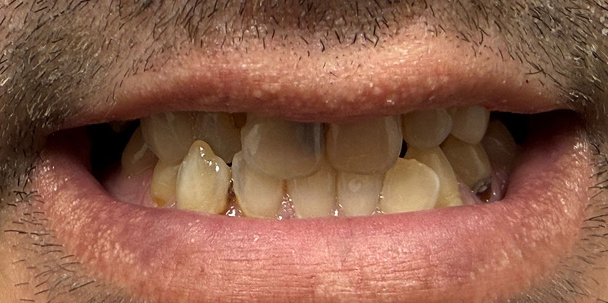 Smile Gallery
