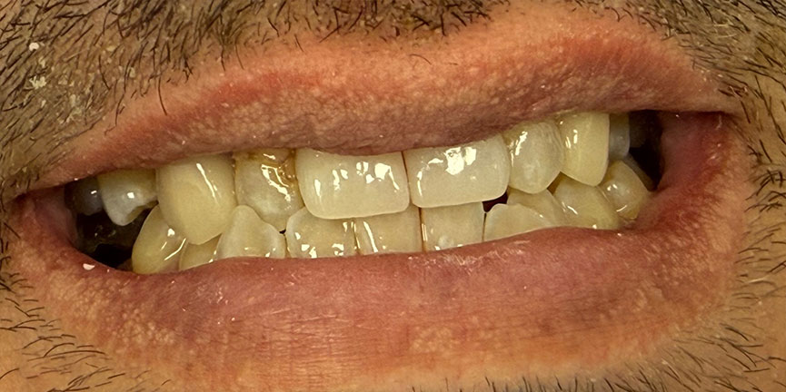 Smile Gallery