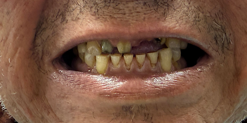 Best Dentist South Pasadena
