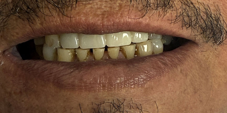 Best Dentist South Pasadena