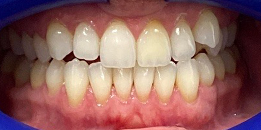 Best Dentist South Pasadena