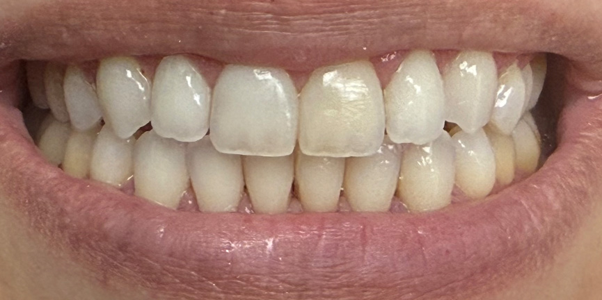 Best Dentist South Pasadena