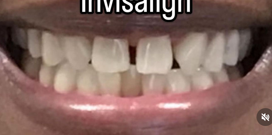 Best Dentist South Pasadena