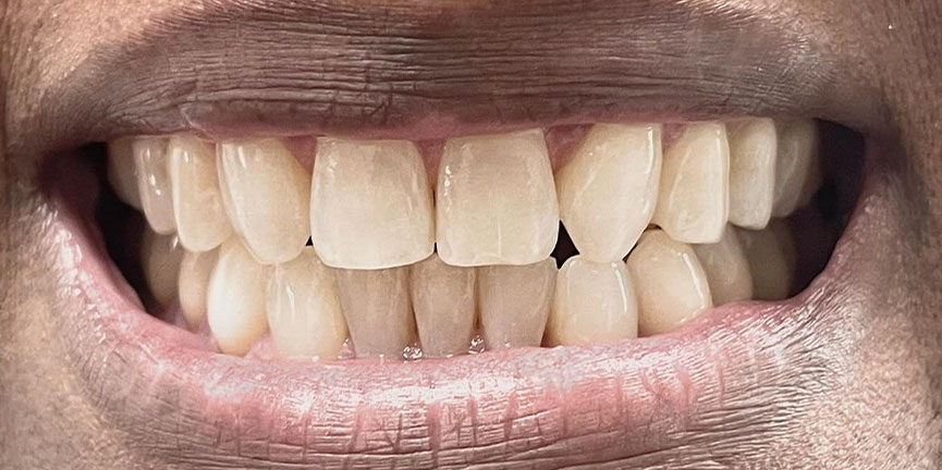 Best Dentist South Pasadena